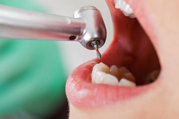 Best Emergency Treatment for Toothache in Shavano Park, TX
